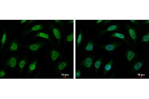 ICC/IF Image hnRNP R antibody [N1N2], N-term detects hnRNP R protein at nucleus and cytoplasm by immunofluorescent analysis. (HNRNPR anticorps  (N-Term))
