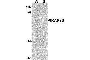 Western Blotting (WB) image for anti-Ubiquitin Interaction Motif Containing 1 (UIMC1) (N-Term) antibody (ABIN1031531)