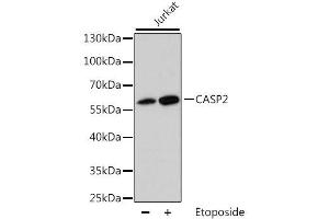 Western blot analysis of extracts of Jurkat cells, using CASP2 antibody. (Caspase 2 anticorps  (AA 153-452))