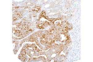 Immunohistochemistry (IHC) image for anti-Fatty Acid Synthase (FASN) (AA 2462-2511) antibody (ABIN7453707)