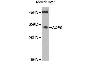 Western blot analysis of extracts of mouse liver, using AQP5 Antibody (ABIN6003635) at 1/1000 dilution. (Aquaporin 5 anticorps)