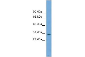 WB Suggested Anti-CNPY3 Antibody Titration: 0. (TNRC5 anticorps  (Middle Region))