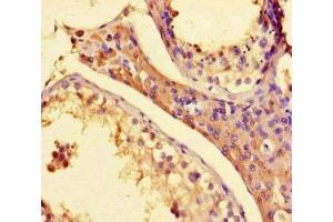 Immunohistochemistry of paraffin-embedded human testis tissue using ABIN7155509 at dilution of 1:100 (SETD1A anticorps  (AA 188-304))