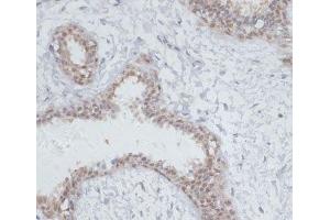 Immunohistochemistry of paraffin-embedded Human breast using NOL3 Polyclonal Antibody at dilution of 1:100 (40x lens). (NOL3 anticorps)