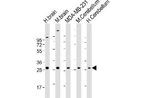All lanes : Anti-RAB23 Antibody at 1:2000 dilution Lane 1: human brain lysate Lane 2: mouse brain lysate Lane 3: MDA-MB-231 whole cell lysate Lane 4: mouse Cerebellum lysate Lane 5: human Cerebellum lysate Lysates/proteins at 20 μg per lane.