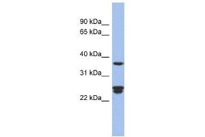 OAZ2 antibody used at 1 ug/ml to detect target protein. (OAZ2 anticorps  (Middle Region))