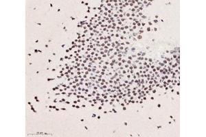 Immunohistochemistry analysis of paraffin-embedded mouse brain using,RBM10 (ABIN7075473) at dilution of 1: 6000