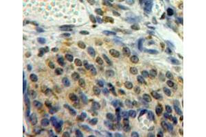 Used in DAB staining on fromalin fixed paraffin-embedded ovary tissue (EGR2 anticorps  (AA 147-403))