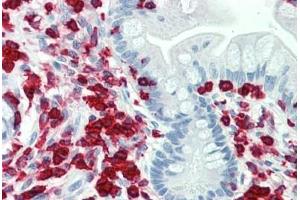 Human Small Intestine: Formalin-Fixed, Paraffin-Embedded (FFPE)