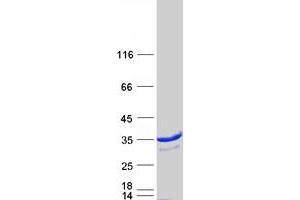 Validation with Western Blot
