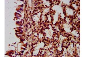 IHC image of ABIN7165873 diluted at 1:400 and staining in paraffin-embedded human lung tissue performed on a Leica BondTM system. (NLRC5 anticorps  (AA 95-208))