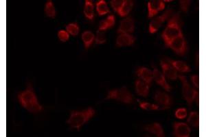 ABIN6274736 staining HepG2 by IF/ICC. (MRPL22 anticorps  (Internal Region))