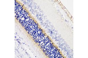 Immunohistochemistry of paraffin-embedded rat retina using  antibody (ABIN6129704, ABIN6136903, ABIN6136905 and ABIN6216979) at dilution of 1:200 (40x lens). (Anoctamin 2 anticorps  (AA 1-200))