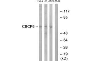 Western Blotting (WB) image for anti-ATP/GTP Binding Protein-Like 4 (AGBL4) (AA 431-480) antibody (ABIN2890251) (AGBL4 anticorps  (AA 431-480))