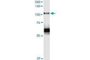 Immunoprecipitation of PLK4 transfected lysate using rabbit polyclonal anti-PLK4 and Protein A Magnetic Bead (PLK4 (Humain) IP-WB Antibody Pair)