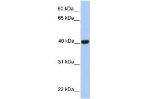 WB Suggested Anti-MGC29891 Antibody Titration:  0. (GABPB2 anticorps  (C-Term))