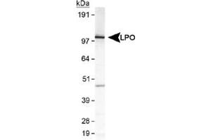 Western blot analysis of LPO in MDA-MB-231 cell lysate using LPO polyclonal antibody . (LPO anticorps  (AA 650-712))