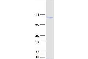 Validation with Western Blot