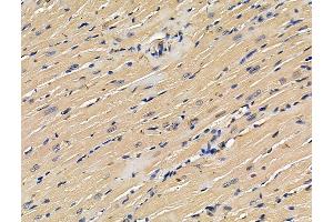 ABIN7096260 and ABIN7100322 at 1/100 staining mouse heart tissue by IHC-P. (Ubiquinol-Cytochrome C Reductase Complex Chaperone (UQCC) anticorps)
