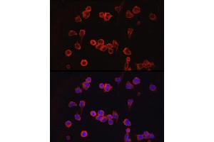 Immunofluorescence analysis of Jurkat cells using NF Rabbit pAb (ABIN3022100, ABIN3022101, ABIN3022102 and ABIN6218604) at dilution of 1:100 (40x lens). (NFATC1 anticorps  (AA 20-300))