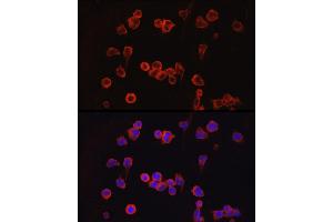 Immunofluorescence analysis of Jurkat cells using NF Rabbit pAb (ABIN3022100, ABIN3022101, ABIN3022102 and ABIN6218604) at dilution of 1:100 (40x lens).