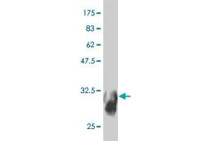 Western Blot detection against Immunogen (31.