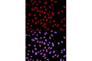 Immunofluorescence analysis of U2OS cell using PTPN6 antibody. (SHP1 anticorps)