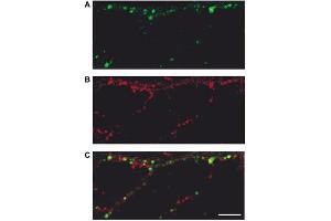 Changes in AMPAR expression on the surface of living hippocampal neurons following high K+ treatment.