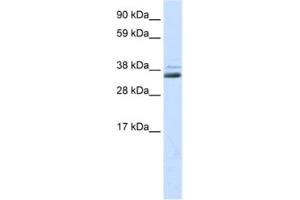 Western Blotting (WB) image for anti-Secreted Frizzled-Related Protein 1 (SFRP1) antibody (ABIN2463723) (SFRP1 anticorps)