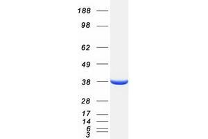 Validation with Western Blot