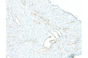 Immunohistochemistry (IHC) image for anti-Cadherin 5 (CDH5) (AA 25-595) antibody (ABIN7453992) (Recombinant Cadherin 5 anticorps  (AA 25-595))