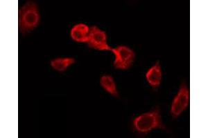 ABIN6274914 staining HeLa by IF/ICC. (Glucuronidase beta anticorps  (Internal Region))