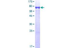 Image no. 1 for Vimentin (VIM) (AA 1-466) protein (GST tag) (ABIN1325010)