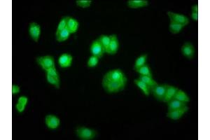 Immunofluorescence staining of HepG2 cells with ABIN7160260 at 1:100, counter-stained with DAPI. (ZFP36 anticorps  (AA 16-103))