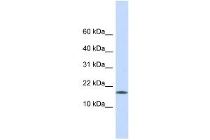 WB Suggested Anti-CENPA Antibody Titration:  0. (CENPA anticorps  (Middle Region))