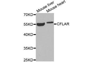 Western blot analysis of extracts of various tissues, using CFLAR antibody. (FLIP anticorps  (AA 161-480))