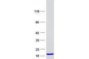Validation with Western Blot
