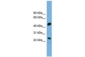 Image no. 1 for anti-Cell Division Cycle Associated 4 (CDCA4) (AA 143-192) antibody (ABIN6745604) (CDCA4 anticorps  (AA 143-192))