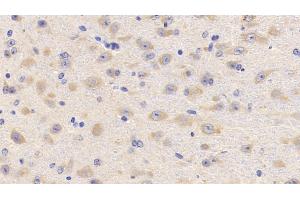 Detection of LCAT in Mouse Cerebrum Tissue using Polyclonal Antibody to Lecithin Cholesterol Acyltransferase (LCAT)