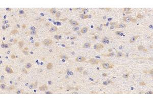 Detection of LCAT in Mouse Cerebrum Tissue using Polyclonal Antibody to Lecithin Cholesterol Acyltransferase (LCAT) (LCAT anticorps  (AA 41-210))