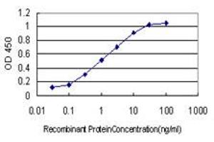 Detection limit for recombinant GST tagged LAMB3 is approximately 0.