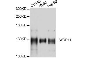 Western blot analysis of extracts of various cells, using WDR11 antibody. (WDR11 anticorps)
