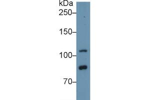 Western blot analysis of Human HeLa cell lysate, using Human TLR5 Antibody (1 µg/ml) and HRP-conjugated Goat Anti-Rabbit antibody ( (TLR5 anticorps  (AA 693-858))
