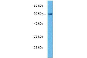 Host:  Rabbit  Target Name:  GPSM2  Sample Tissue:  Human Ovary Tumor  Antibody Dilution:  1ug/ml