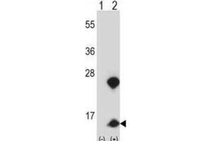Western Blotting (WB) image for anti-High Mobility Group Nucleosome Binding Domain 1 (HMGN1) antibody (ABIN2997819) (HMGN1 anticorps)