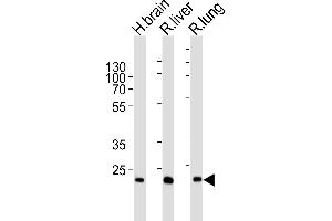 Western blot analysis of lysates from human brain , rat liver and lung tissue lysate (from left to right), using GSTT1 Antibody (N-term) (ABIN6244315 and ABIN6577396). (GSTT1 anticorps  (N-Term))