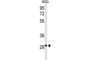 Western Blotting (WB) image for anti-Nicotinamide Riboside Kinase 1 (NMRK1) antibody (ABIN3004262) (NMRK1 anticorps)