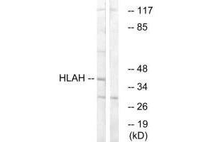 Western blot analysis of extracts from LOVO cells, using HLAH antibody.