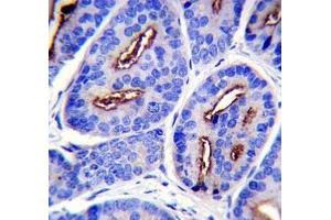PSMA antibody immunohistochemistry analysis in formalin fixed and paraffin embedded human prostate carcinoma.