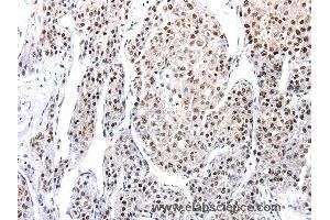 Immunohistochemistry of Human tonsil  using AQP2 Polyclonal Antibody at dilution of 1:100 (AQP2 anticorps)